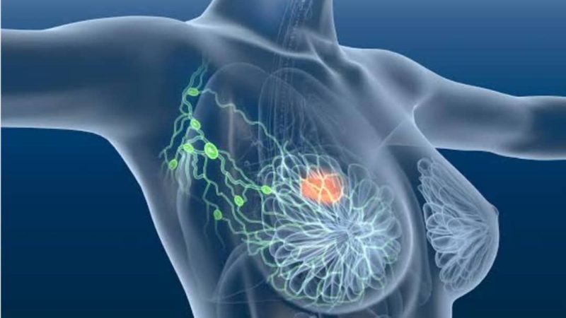 ITURI : l&rsquo;Association des Femmes Médecins en guerre contre le cancer de seins et appelle au dépistage de cette maladie ( communiqué)