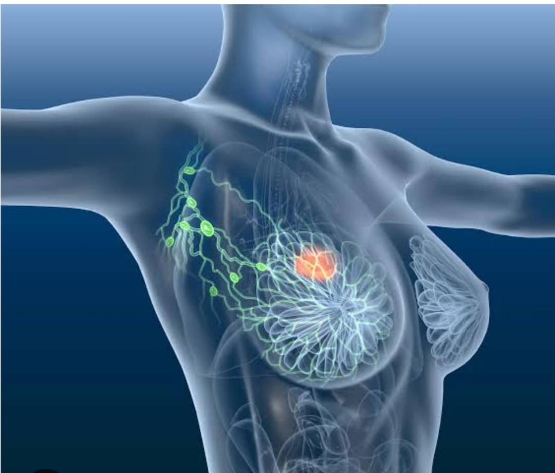 ITURI : l&rsquo;Association des Femmes Médecins en guerre contre le cancer de seins et appelle au dépistage de cette maladie ( communiqué)